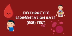 Read more about the article What Is ESR Test Used to Diagnose? Full Guide to ESR Blood Test and Results in 2025